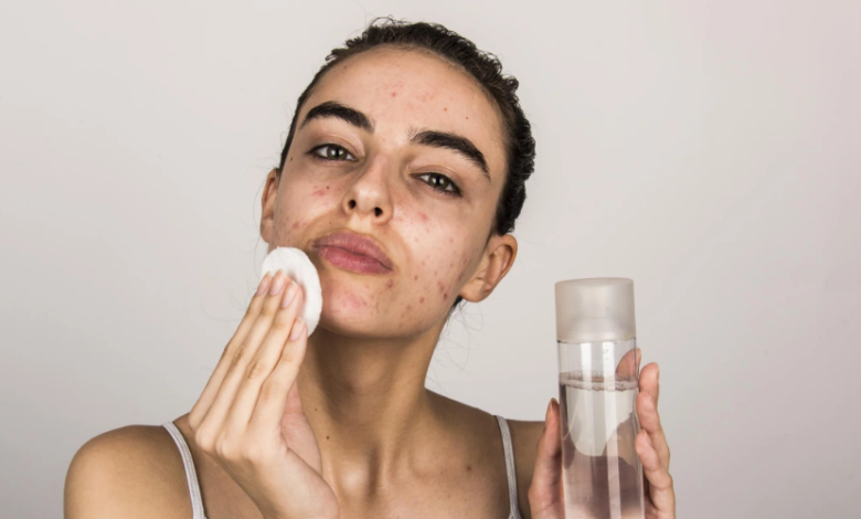 Best Skincare Routine with Salicylic Acid Face Wash for Oily and Acne-Prone Skin